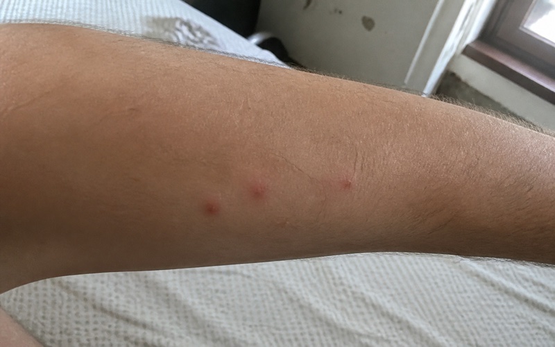 Blakšu kodumi — kā tos atpazīt